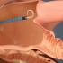 左心耳封堵手术预防房颤引起的血栓，3D演示。。