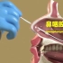 医学科普：鼻咽拭子3D动画演示
