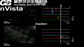 引体向上多久测试一次极限 ad59e556f45baed4e3e7dec2da45509ee6e654f9.jpg@280w_158h_1c_100q.jpg
