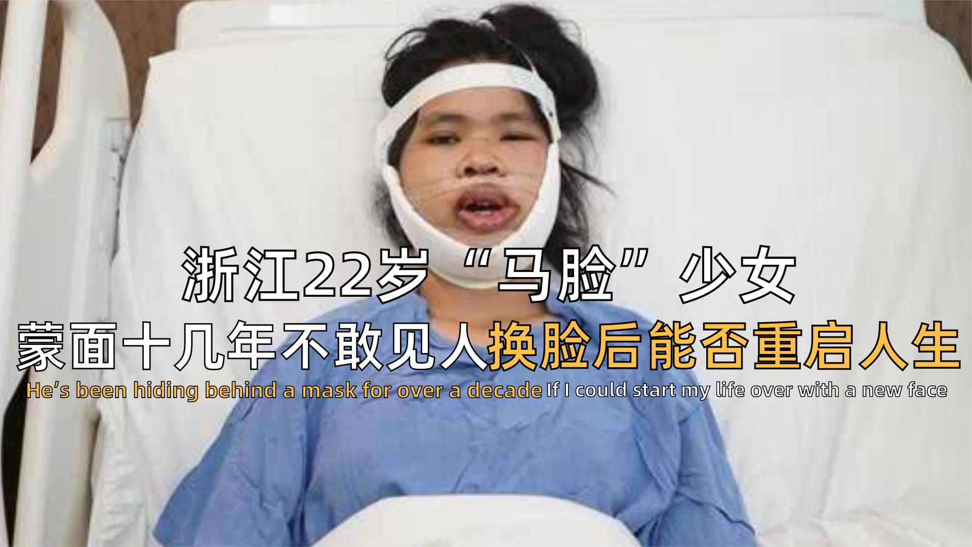 “马脸女孩”吴小燕，面部肿瘤让她命悬一线，换脸后能否重获新生