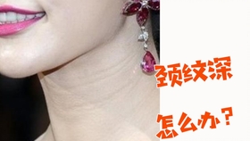 ae995c15e12cbe8970414d66adbe5fd524a26082.jpg@280w_158h_1c_100q.jpg