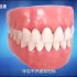 牙齿正畸可以矫正哪些症状？