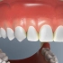 为什么要使用牙线清理口腔？