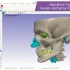 【Simpleware】U-2022.12版本新增：AS Ortho/CMF模块颅颌面CT自动分割