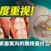 千万要小心牙齿表面的小黑缝，内部可能已经