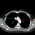 8.心血管影像解剖图谱--(主动脉弓-颅内动脉段)CT解剖