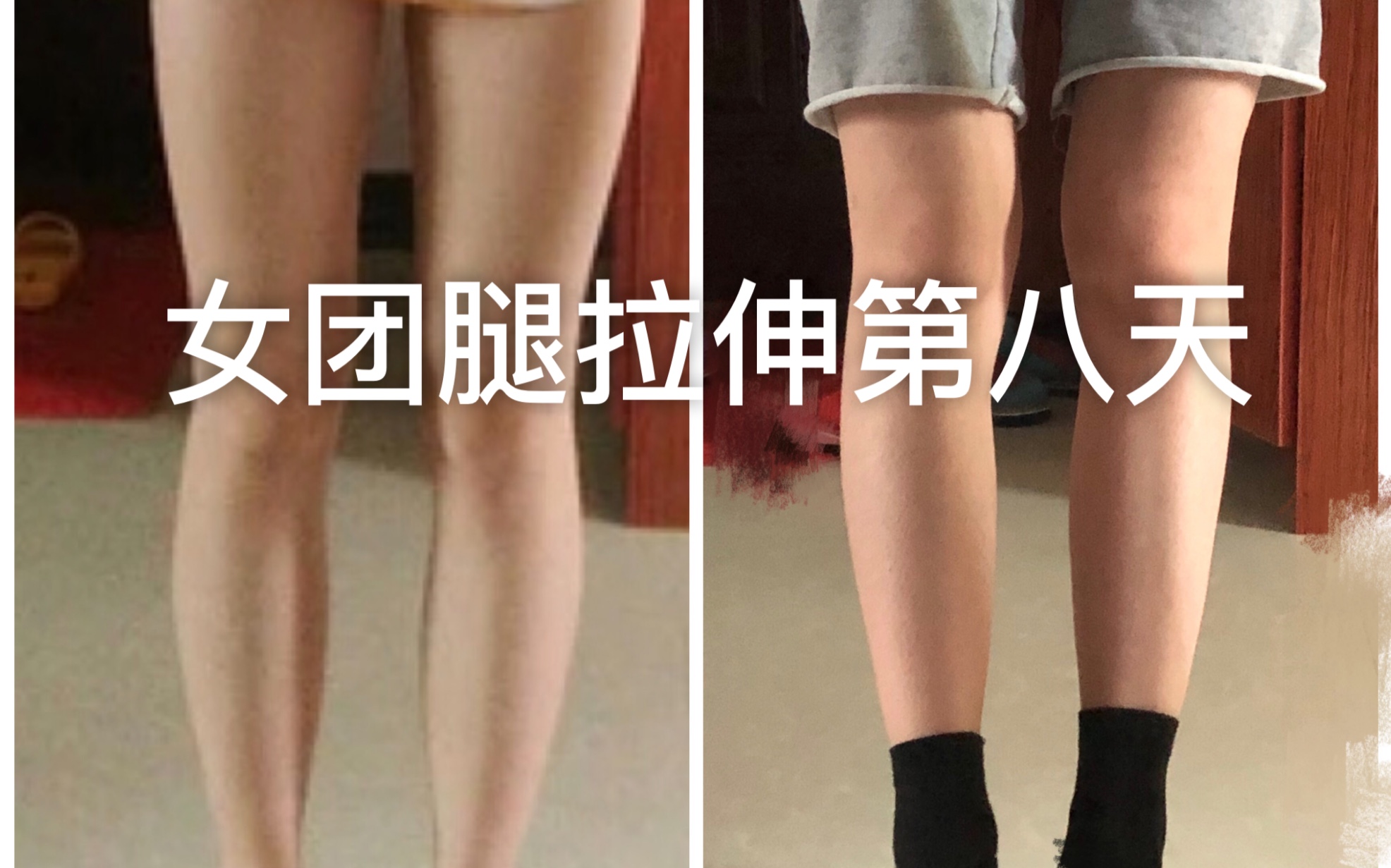 【女团腿瘦小腿】女团腿效果反馈 打卡第八天 目前小腿右31左30.7左右  之前32