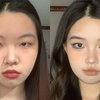 凸嘴自救｜全方位改善嘴凸下巴后缩