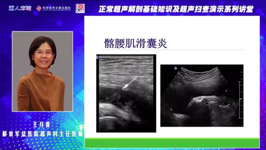 肌骨超声 髋关节上 王月香