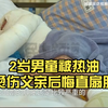 2岁男童被热油烫伤父亲后悔直扇脸