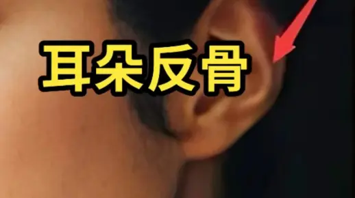 耳朵反骨好吗