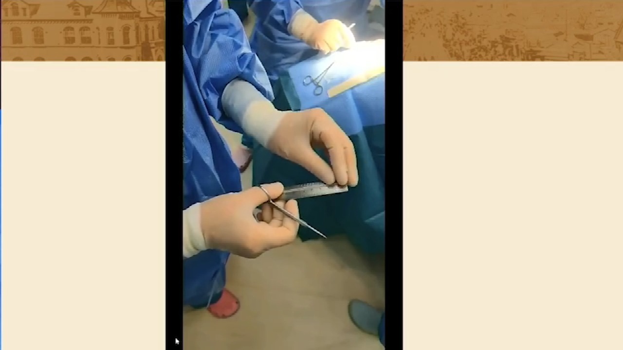 眼科专家张风教授讲解《间接检眼镜下巩膜扣带手术手术技巧》