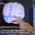 “VR黑科技” 来看看外科医生如何使用VR技术做脑部手术！