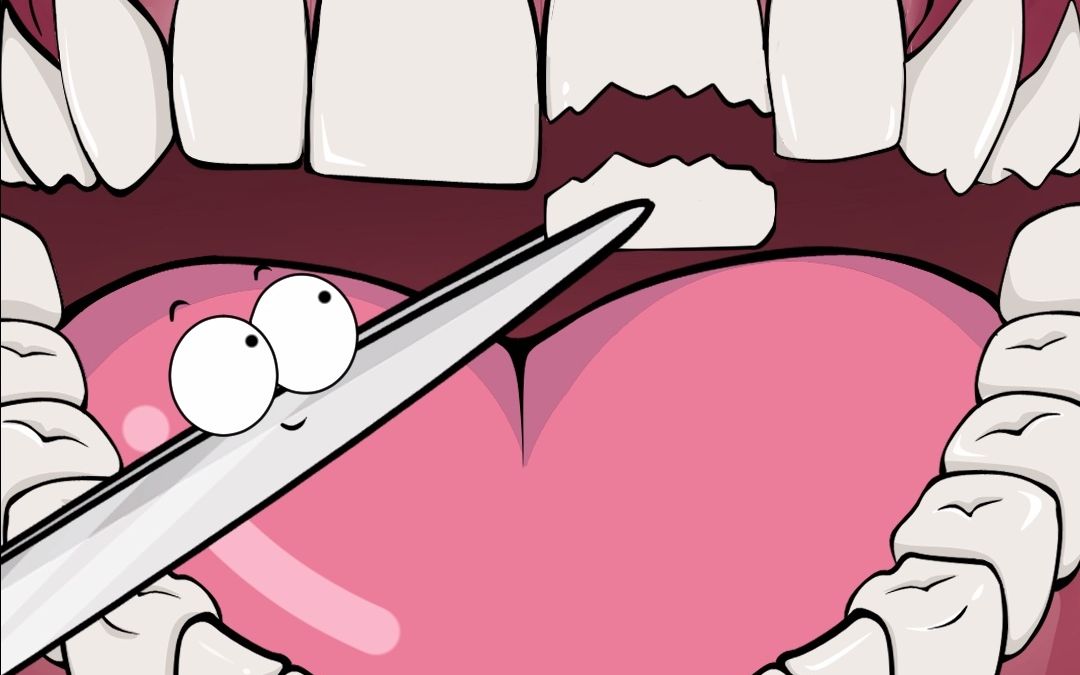 断了的牙是怎么安回去的？