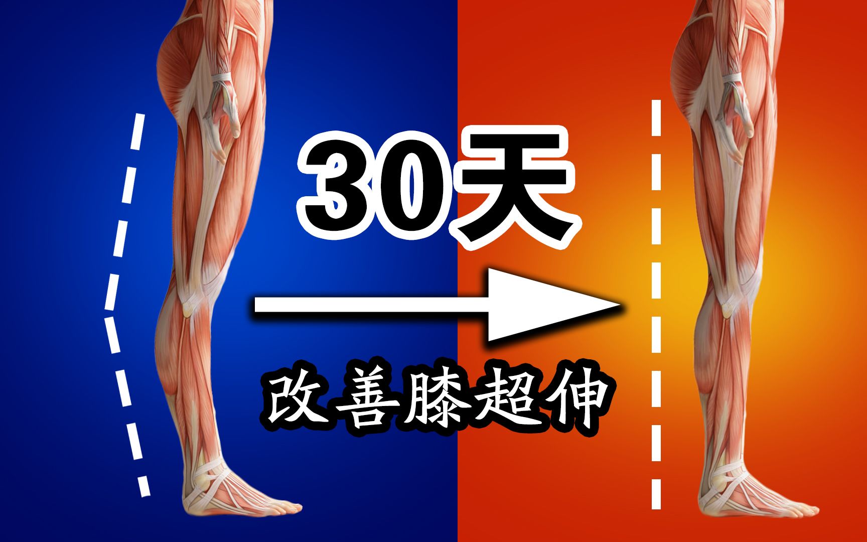 3分钟改善膝超伸运动，矫正膝盖前突，给你笔直腿型。