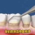 牙龈出血是怎么造成的？