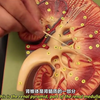 肾的解剖结构 | Kidney Anatomy