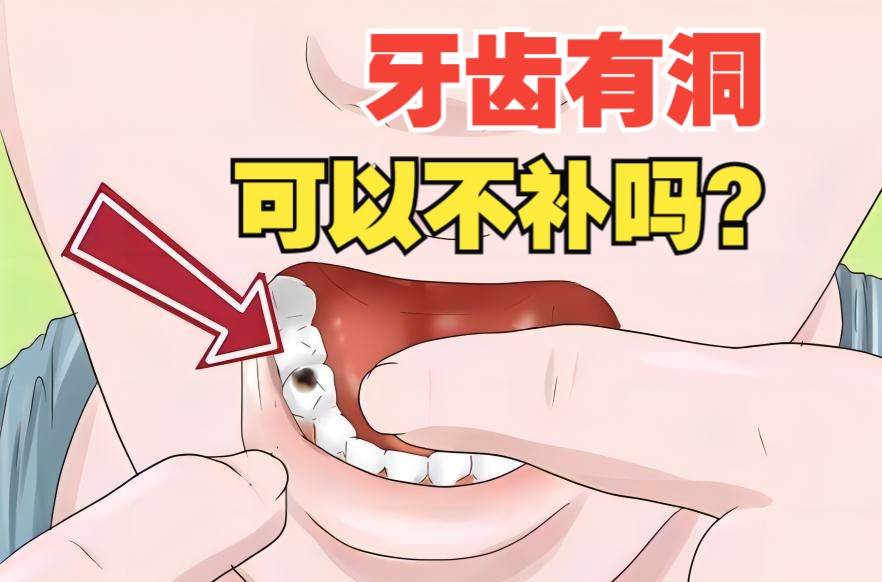 牙齿有洞不疼可以不补吗？