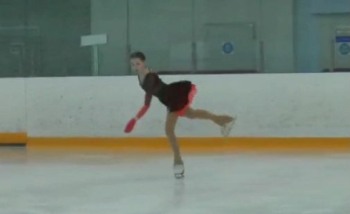 Anna Shvetsova在比赛中不幸摔倒，太阳穴撞到了冰上