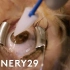 真实记录视力矫正激光手术的全过程，看完你还敢近视吗？