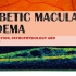 Diabetic Macular Edema made incredibly easy - 糖尿病性黄斑水肿