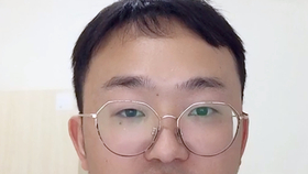 什么方法止鼻血最快最有效 c0df4c46998515ffeb02ece32095977ab954bf74.jpg@280w_158h_1c_100q.jpg