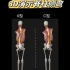3D演示脊柱侧弯｜解剖学分析一目了然