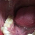 检查一下牙齿喉咙的健康情况