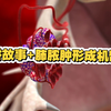 当我用讲故事的形式讲肺脓肿形成的机制？（大家点点关注嘛