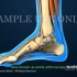 【3D医学动画】踝关节损伤（原版英文+中英双字幕）