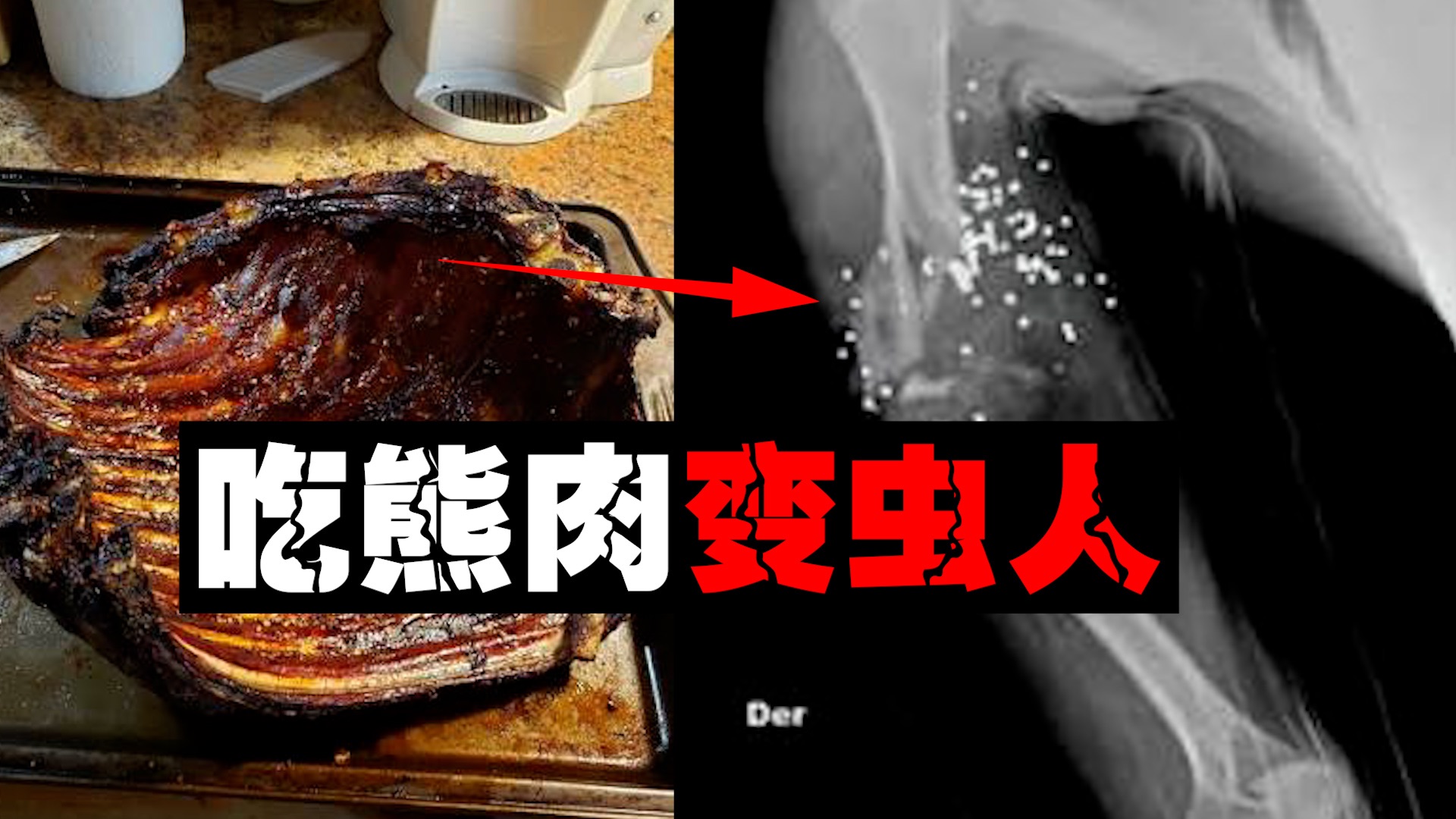 【熊虫入侵】22人吃了烤熊肉，6周后他们的肌肉被虫蛀穿。。。