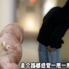 《痔疮の终极羞辱VS痊愈の高光时刻！10年痔友亲测：这东西让我重获"坐"人尊严