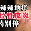 【科普】身上瘙痒难耐，越抓越痒，越痒越抓，人都麻了！老蔡教你这样处理