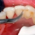 你知道你的牙齿里面有多脏吗？