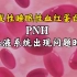 【英文字幕】阵发性睡眠性血红蛋白尿PNH的病因