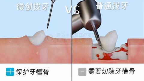 怎么快速解决牙痛 c71fb84a2d6dd49fec021ae93e1500b506054547.jpg@480w_270h_1c