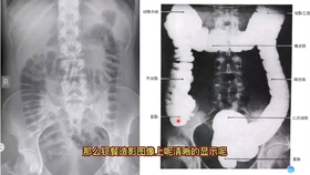 c7a456e8d20f65700d36ae609d6d2b43e6b61b4b.jpg@280w_158h_1c_100q.jpg