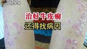 c82ac13350c699d5cba1208063df4f5a75fd952b.jpg@280w_158h_1c_100q.jpg