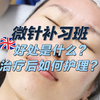 微针是什么?注意事项