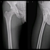 膝关节平片