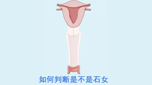 如何进行判断是不是石女