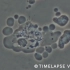 显微镜下的自然杀伤细胞（NK 细胞）击碎癌细胞