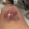 重口！超级重口