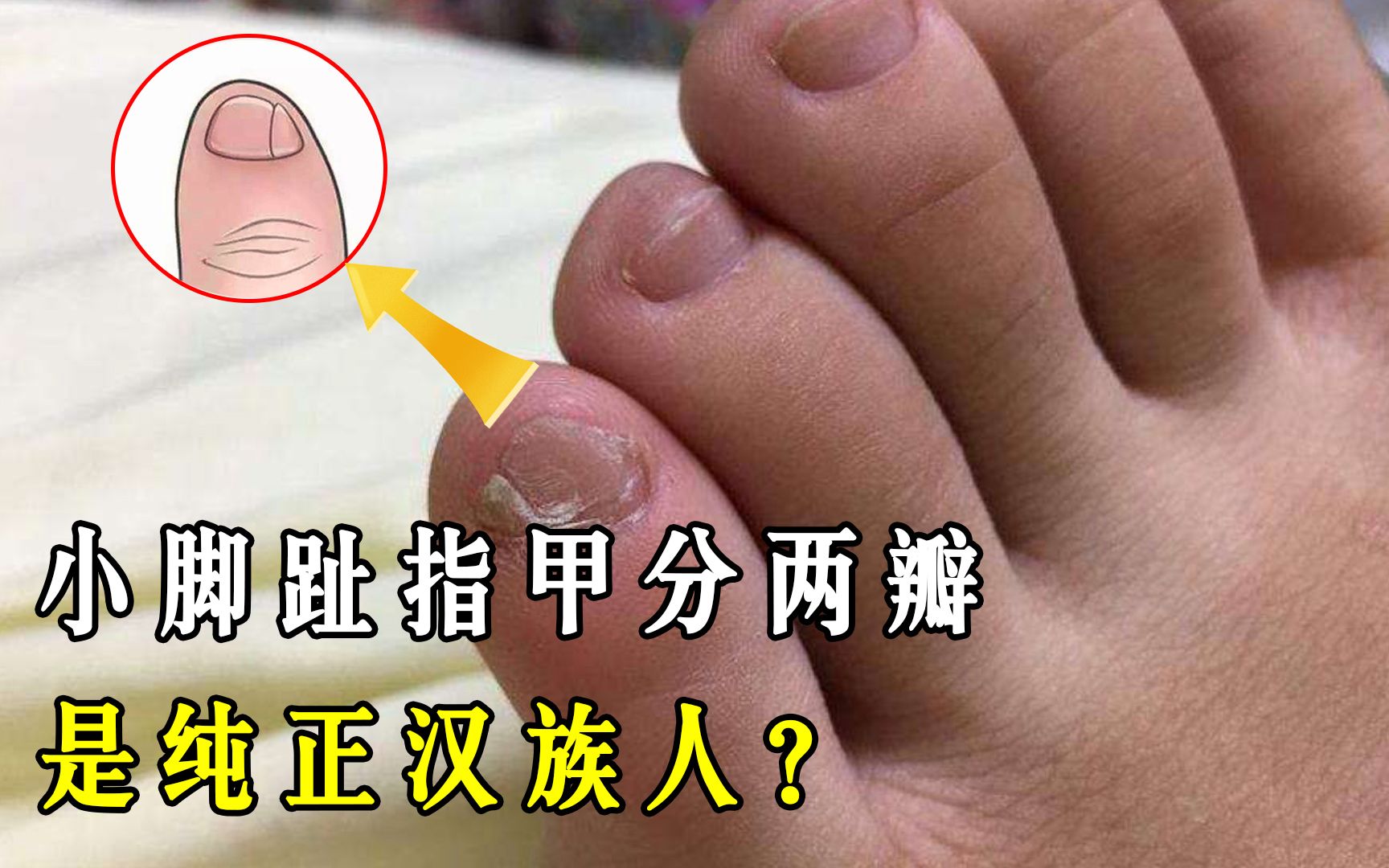 🎉 Chinese foot binding tradition. 10 Facts about Chinese Foot Binding. 2019-02-09