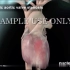 【医学动画nucleus】心脏瓣膜置换术nucleus动画演示
