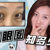要问黑眼圈咋能浅？了解清楚原因是关键！三种黑眼圈终极形态你是哪种？【太阳婶子