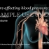 医学科普——高血压