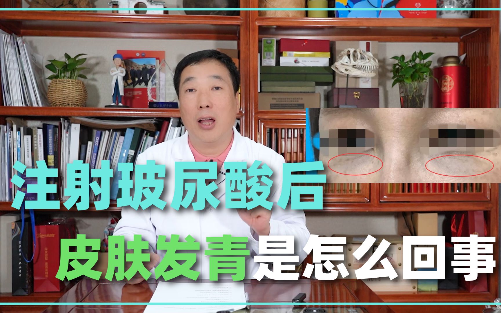【乔雅登玻尿酸】改善亚洲人下巴后缩问题，优化五官比例提升精致度 | 佳思优整形医美诊所