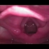 喉位置和形态-喉