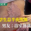 女大学生总半夜洗澡，男友：浴室落满皮屑！#银屑病